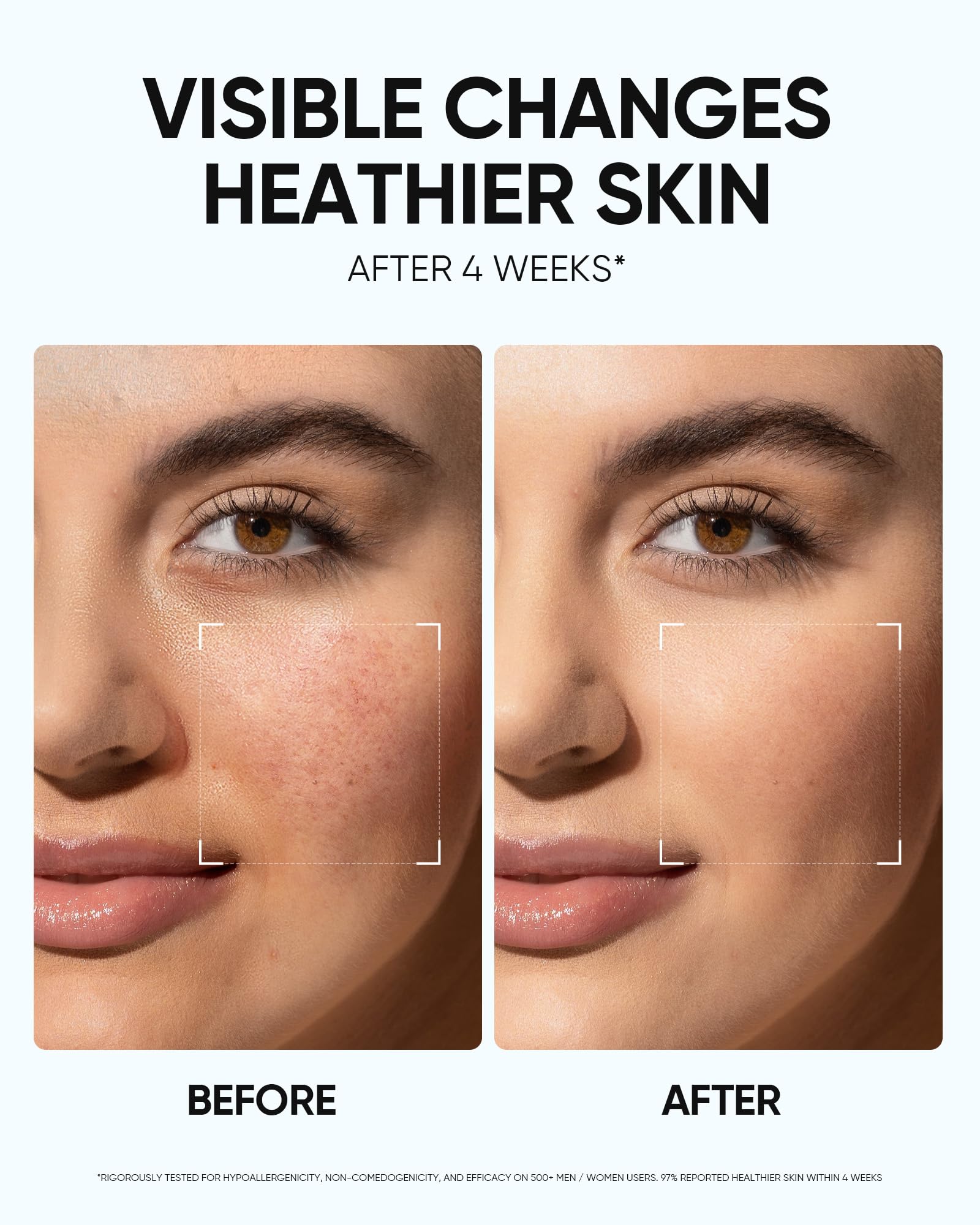 SKINTIFIC Hyaluronic Acid Centella moisturizer hydrates and soothes texture