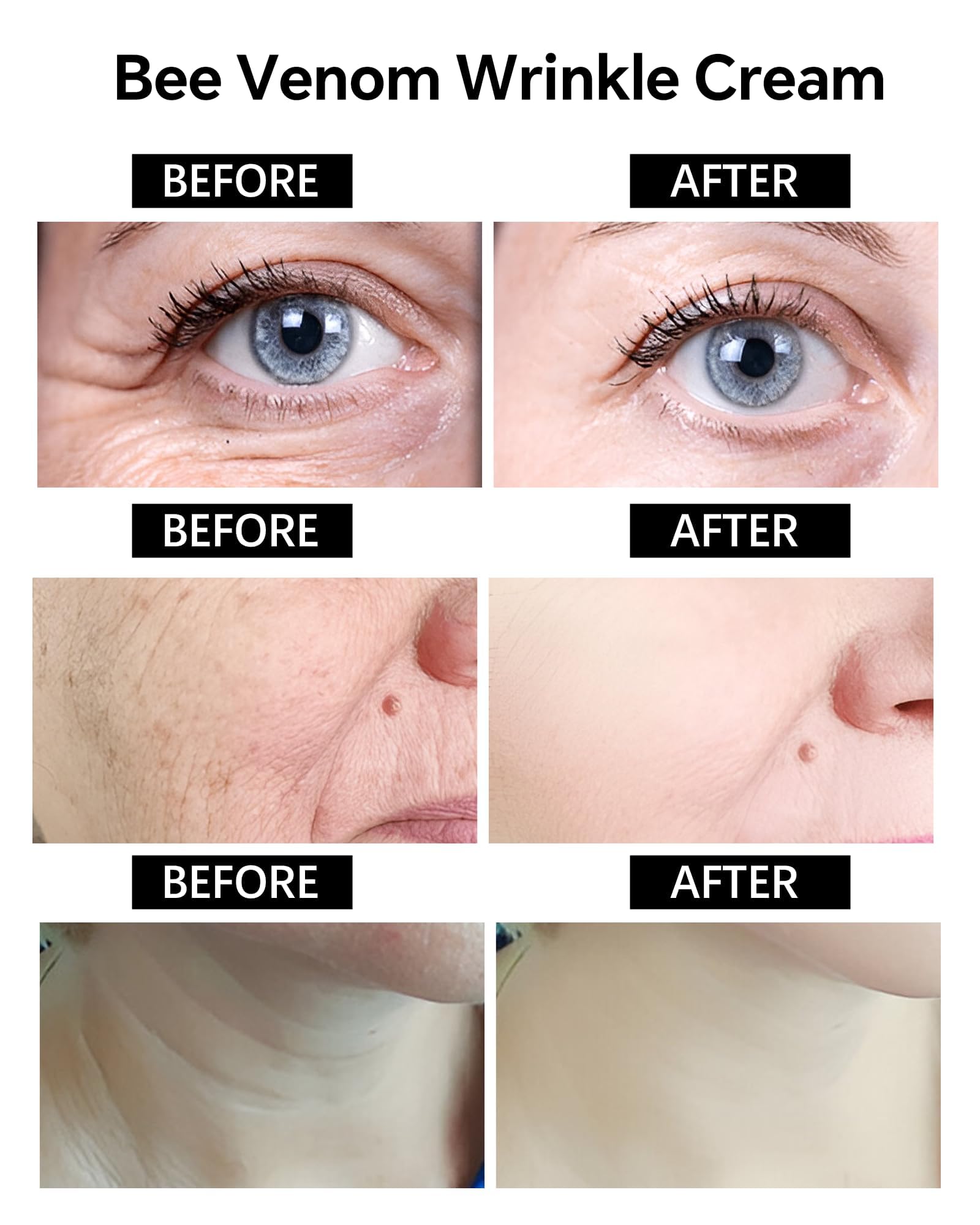 Skyoyo BotoxCream aplicación diaria rostro, cuello y manos para cuidado completo.