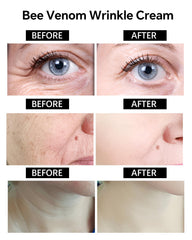 Skyoyo BotoxCream aplicación diaria rostro, cuello y manos para cuidado completo.