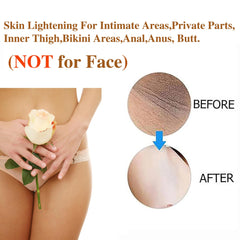 SmileFace crema aclaradora para muslos internos, textura ligera y suave.