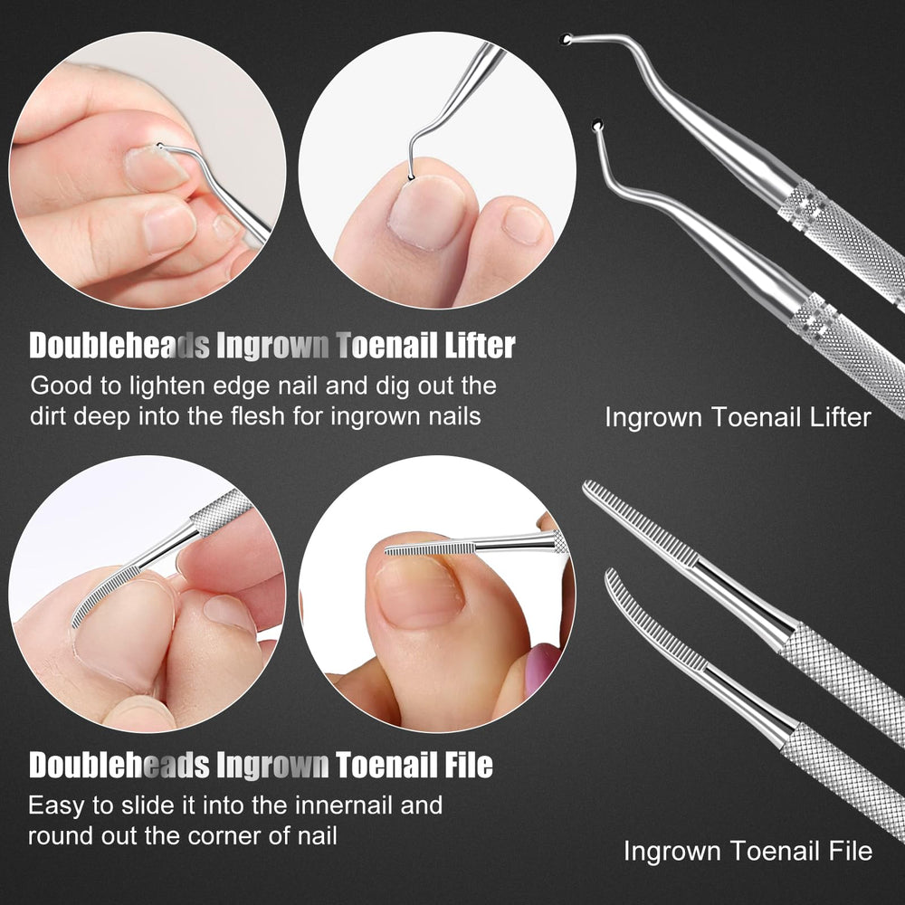 SMZHealing double-headed files and rasps refine edges for smoother nails.