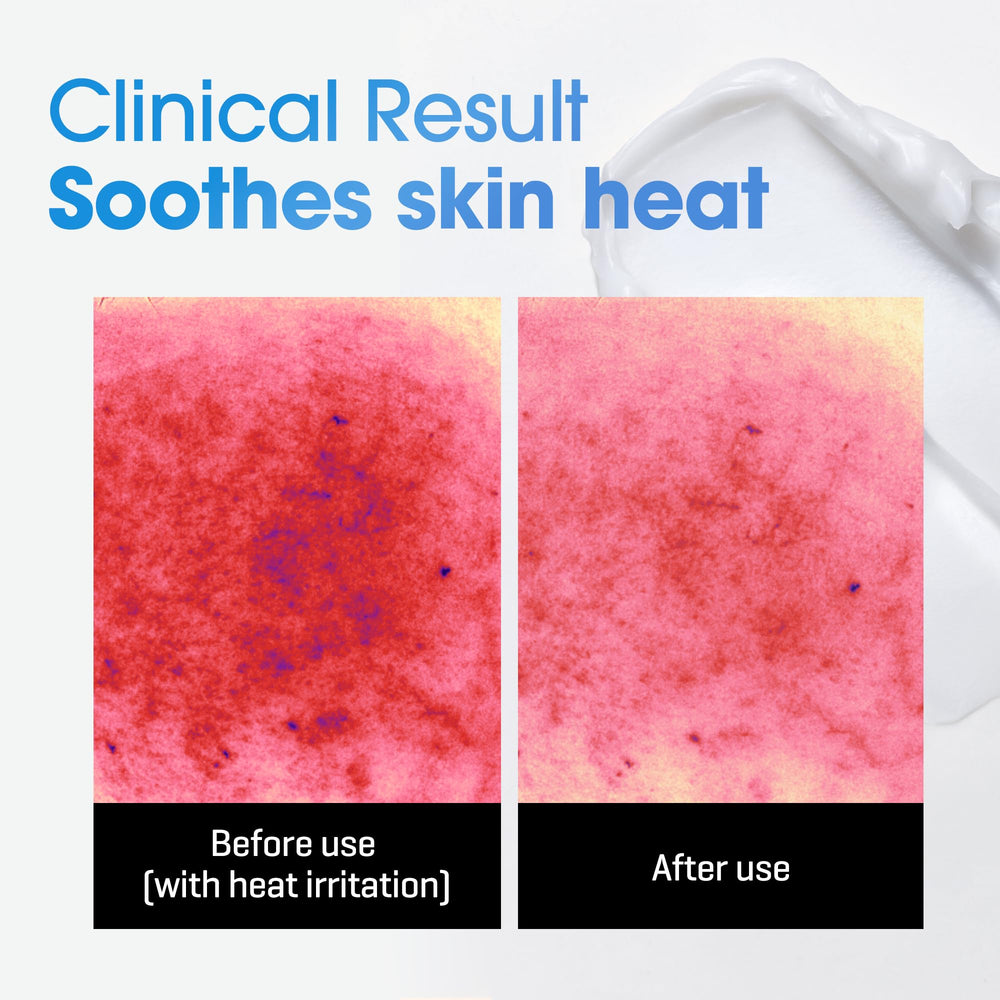 SOME BY MI Beta-Pantenol Repair Body Cream, manos aplicando; ayuda a hidratar la piel.