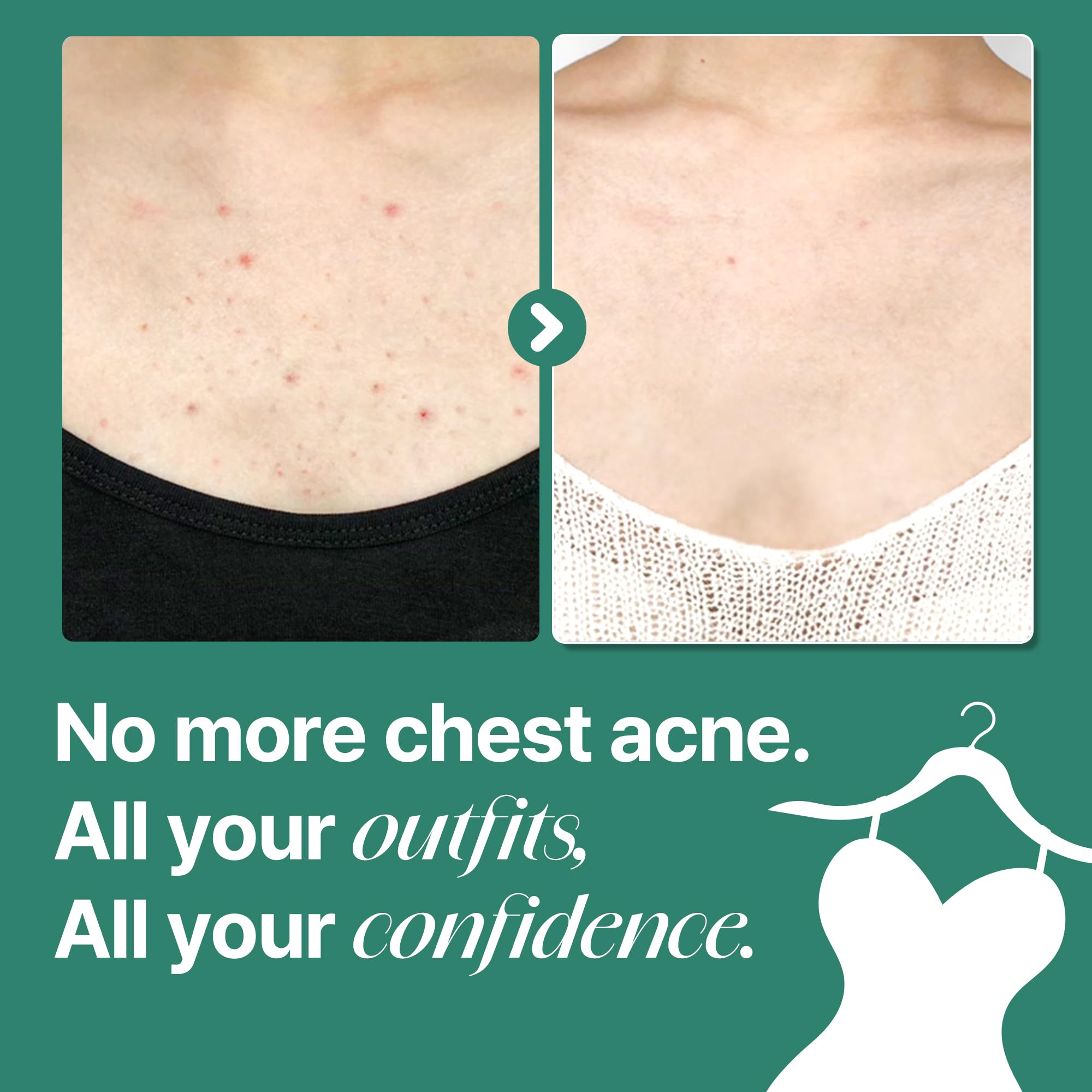 SOME BY MI Truecica calming extract close-up for sensitive skin protection