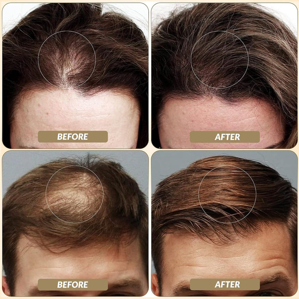 SOVONCARE: fibras capilares que hacen el cabello más grueso y voluminoso al instante