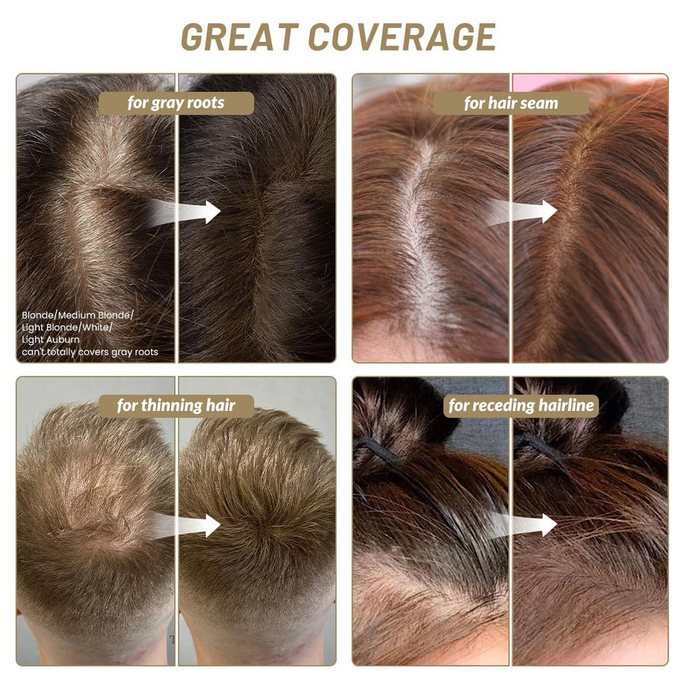 SOVONCARE Hairline Powder applied along hairline for a natural-looking blend