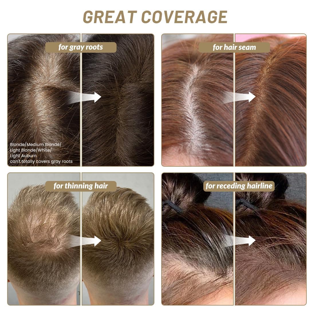 SOVONCARE thinning hair cover application for instant fullness