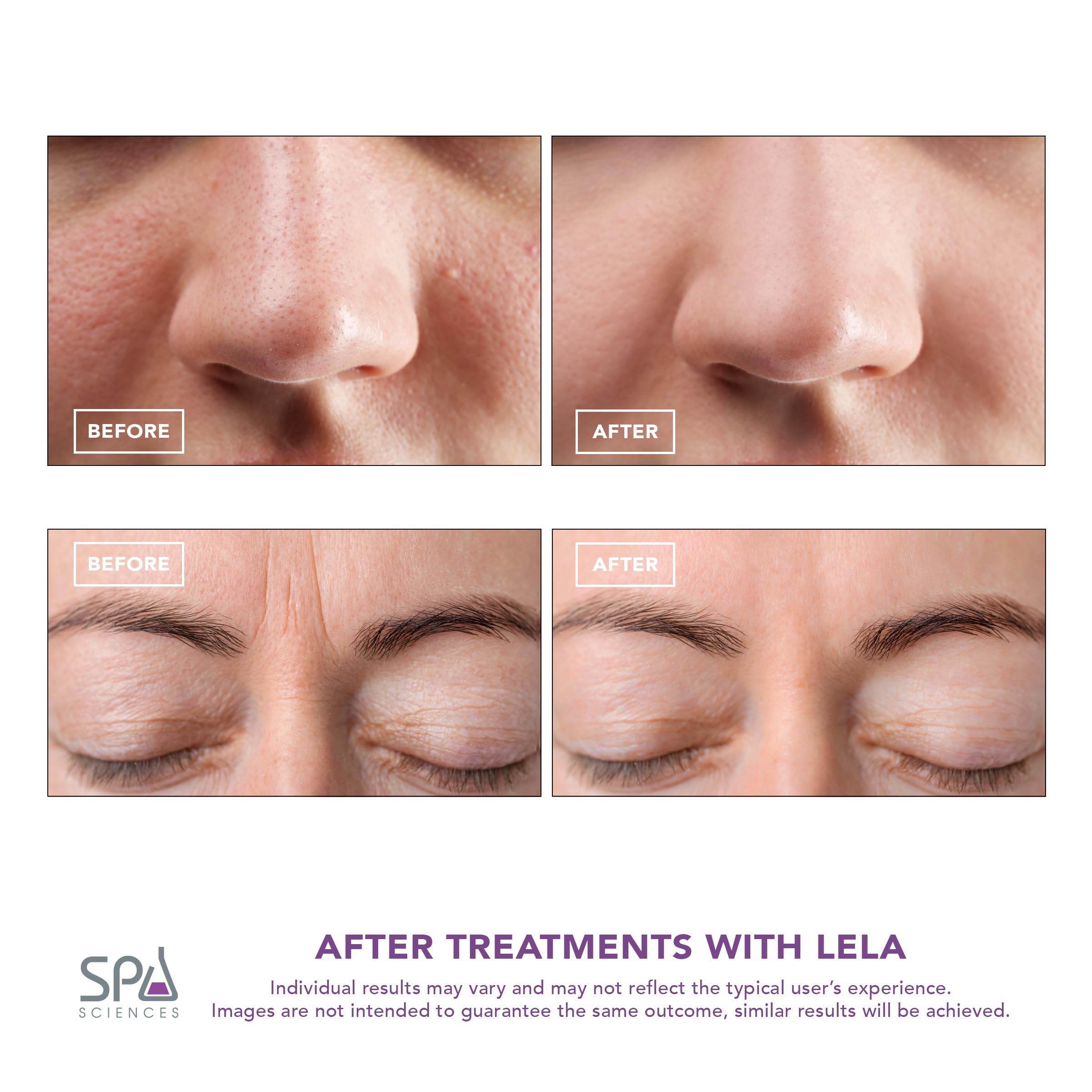 Spa Sciences LELA deep cleansing with ion technology supports a clean surface.