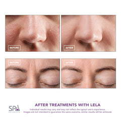 Spa Sciences LELA deep cleansing with ion technology supports a clean surface.
