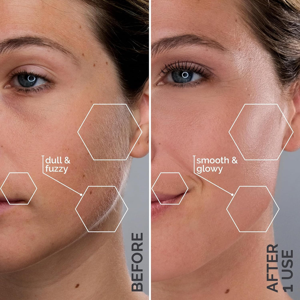 SPA SCIENCES SIMA razor in hands performing painless peach fuzz removal