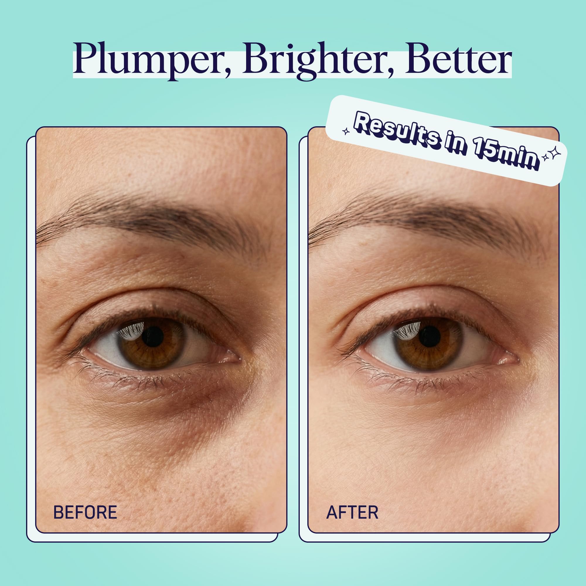 SpaLife pepino frigorifico: parche para ojos que se puede enfriar para mayor frescura.