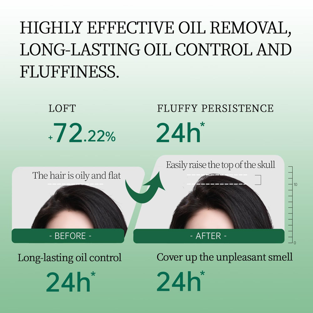 Spes Dry Shampoo Segunda Generación, textura en gel sin residuos para limpieza rápida