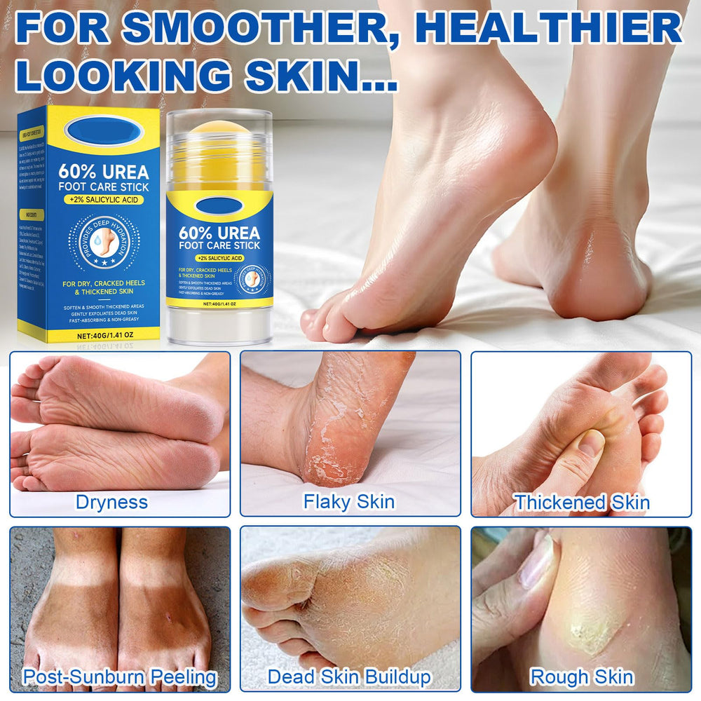 Springsugar stick ureaa60-salicilico2: ingredientes potentes para renovar la piel muerta de pies.