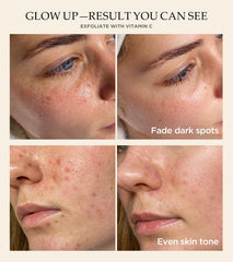 Srripo exfoliante facial con vitamina C y cúrcuma, ingredientes iluminadores.