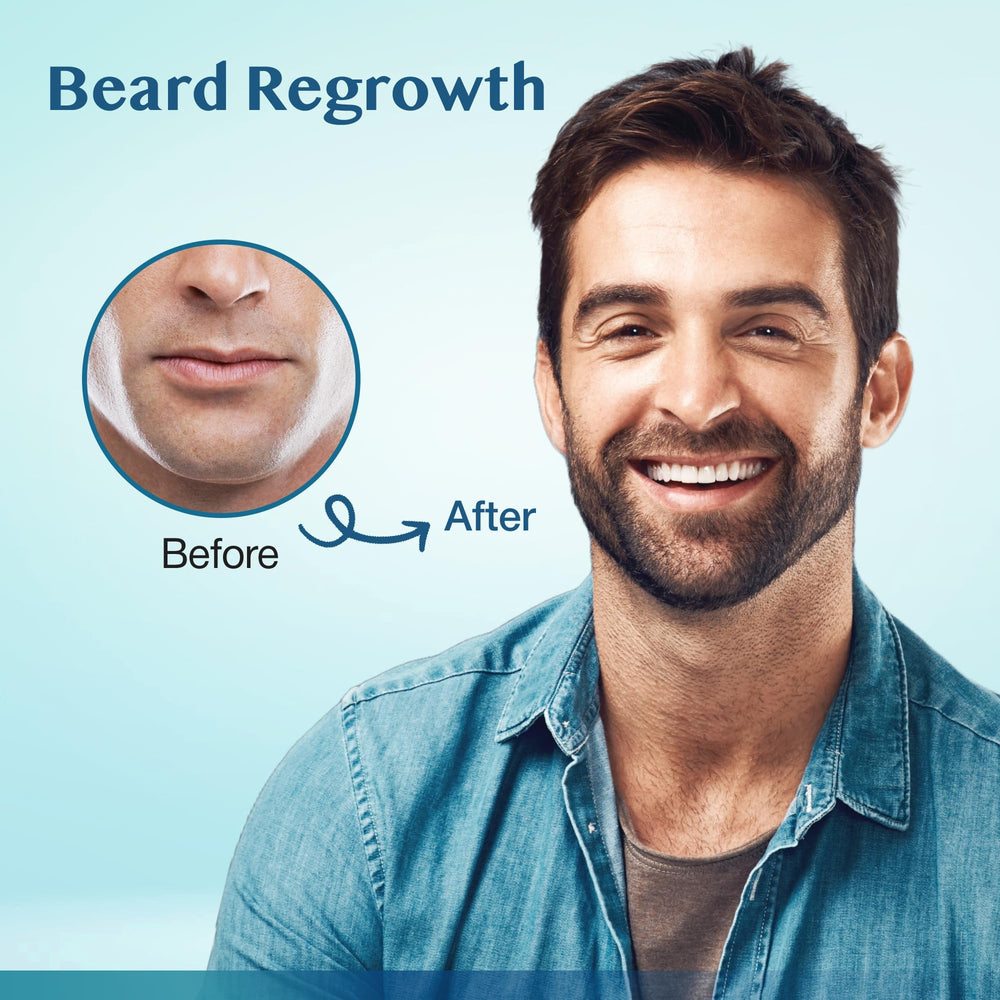 Stafenit thinning-crown-area application targets crown thinning with minoxidil support.