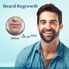 Stafenit thinning-crown-area application targets crown thinning with minoxidil support.