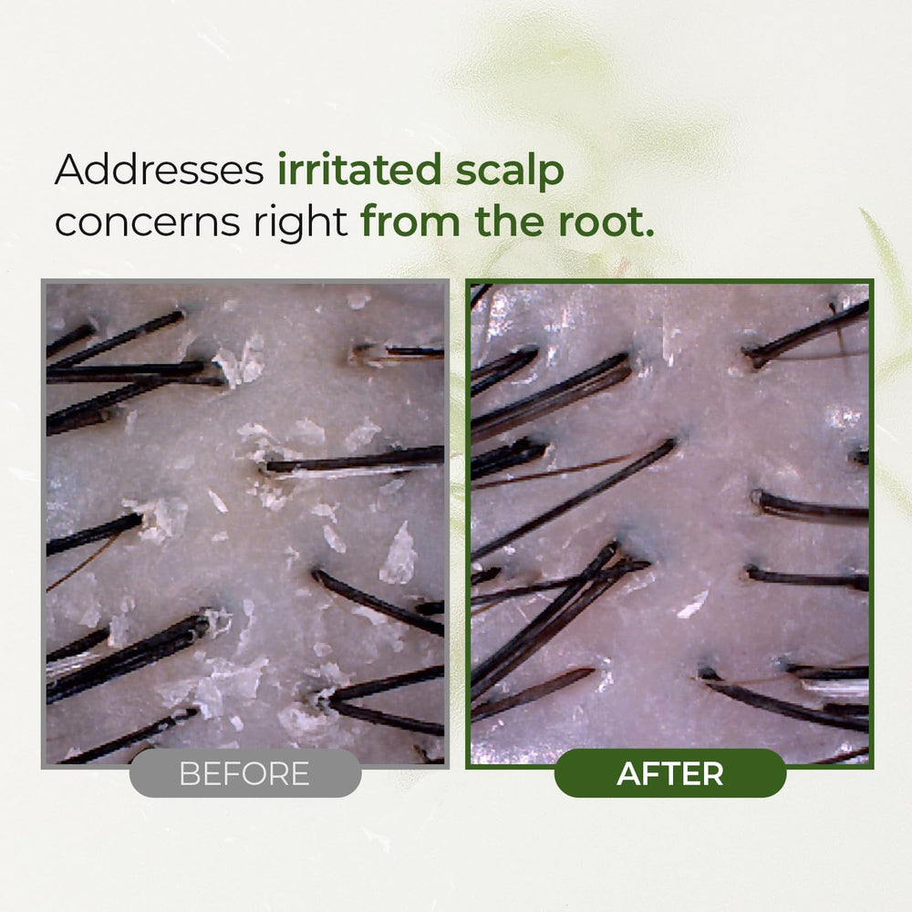 Steambase Tea Tree Scalp Treatment vegan cruelty-free packaging on shelf.