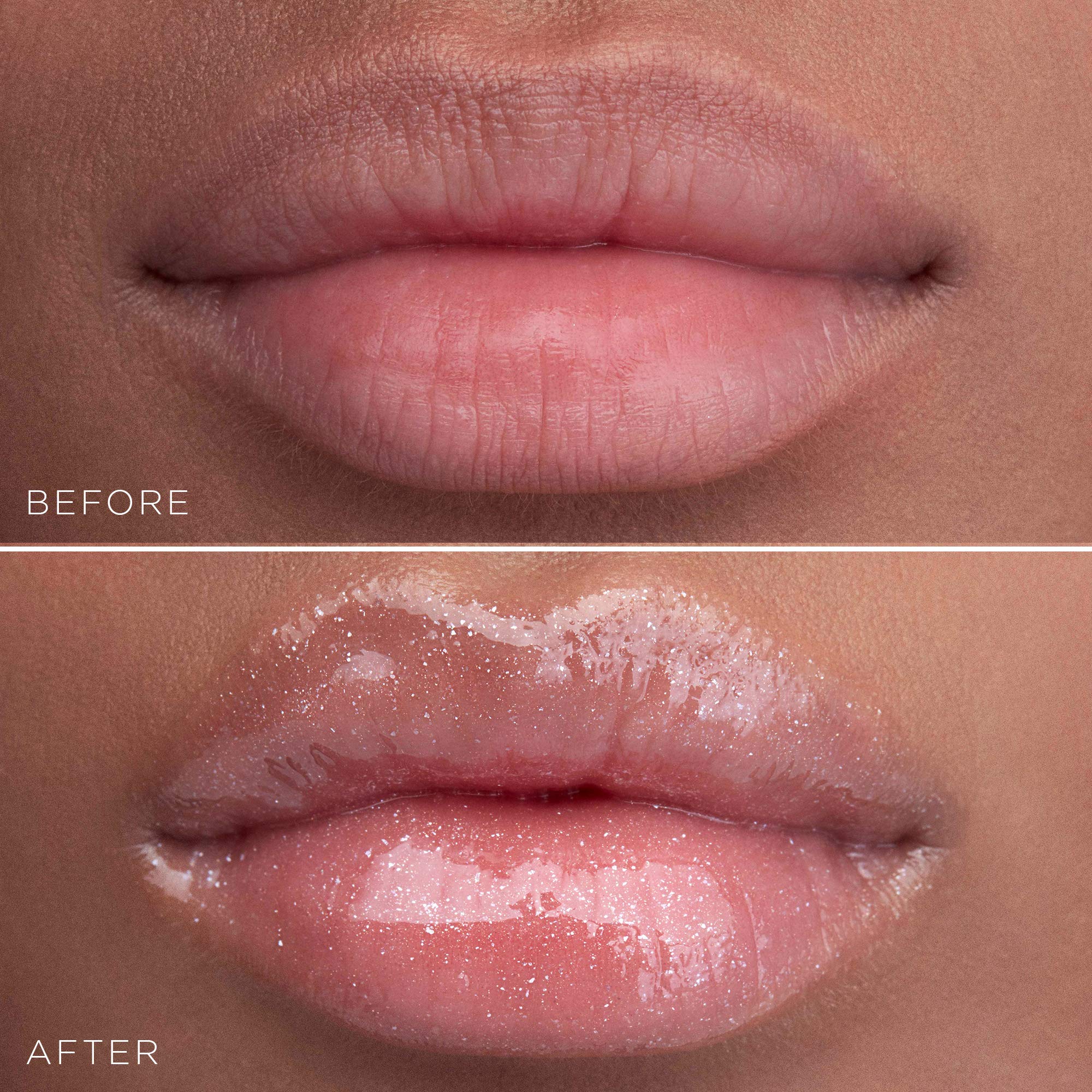 Close-up of lips with pronounced shine and plump-looking definition.