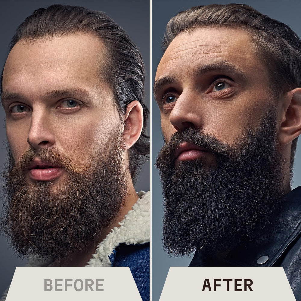 Striking Viking oil on dry skin providing itch relief and hydration.