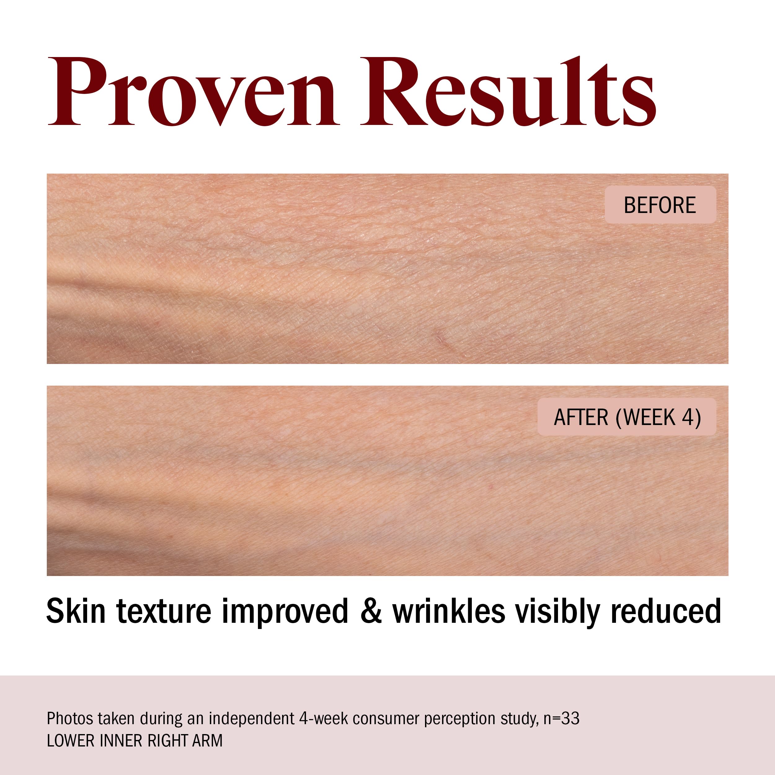 STRIPES Beauty arm-hip-stomach area product application shown for crepey-looking skin.