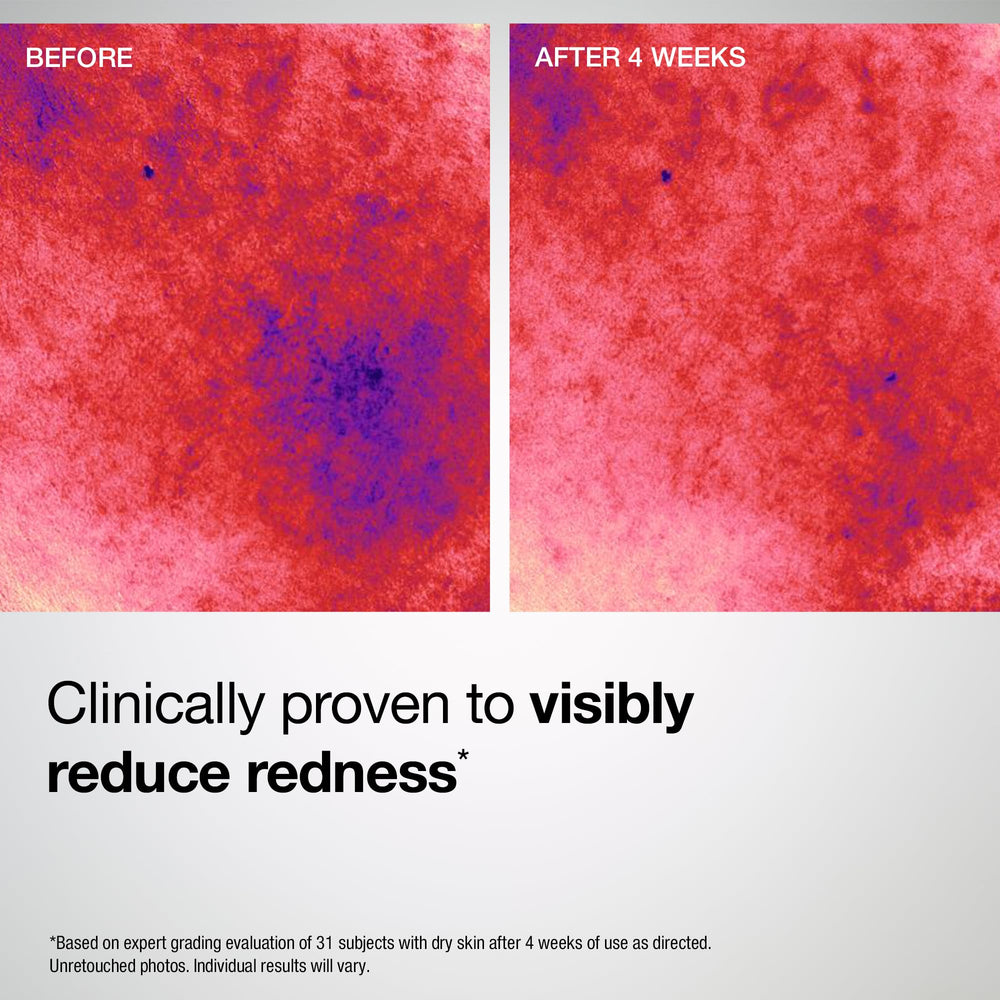 StriVectin Barrier Restore turmeric-peptide focus for redness support.