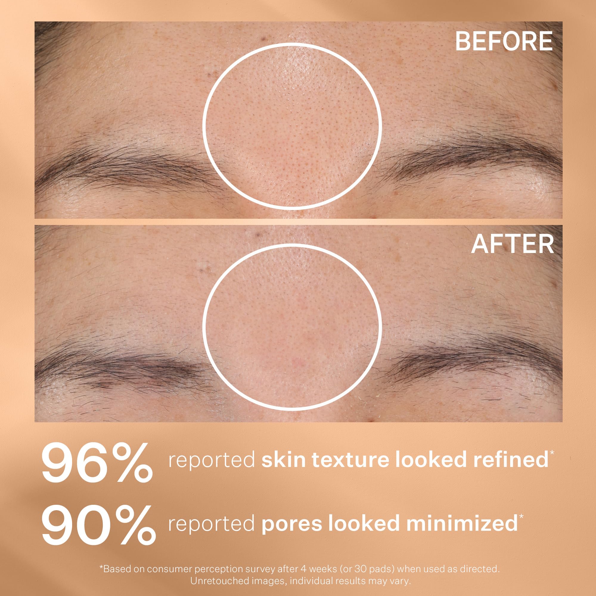 StriVectin Daily Reveal before-after hints at reduced dullness.