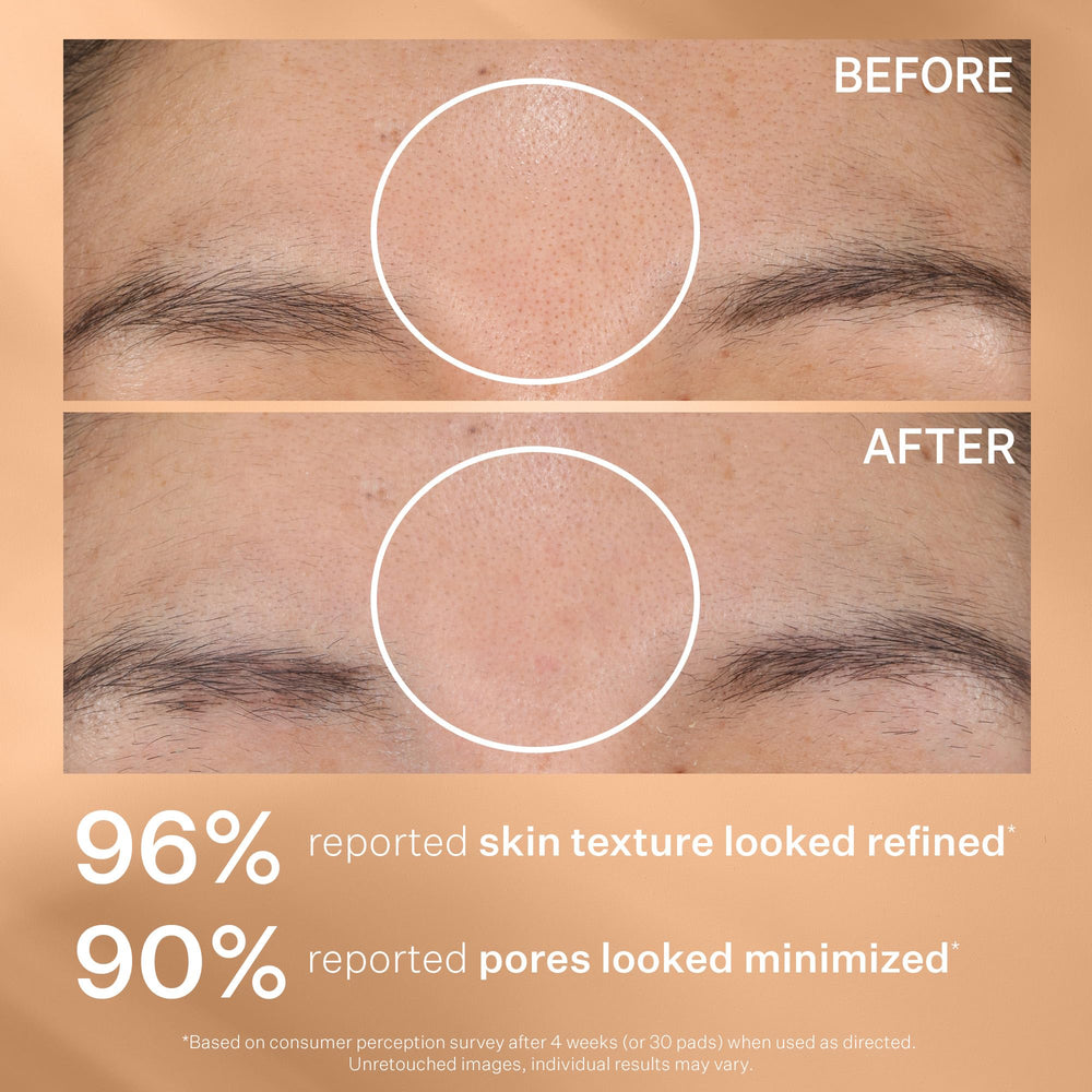 StriVectin Daily Reveal before-after hints at reduced dullness.