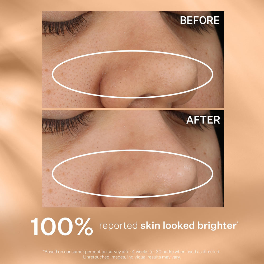 StriVectin Daily Reveal shows brighter, more even skin after use.