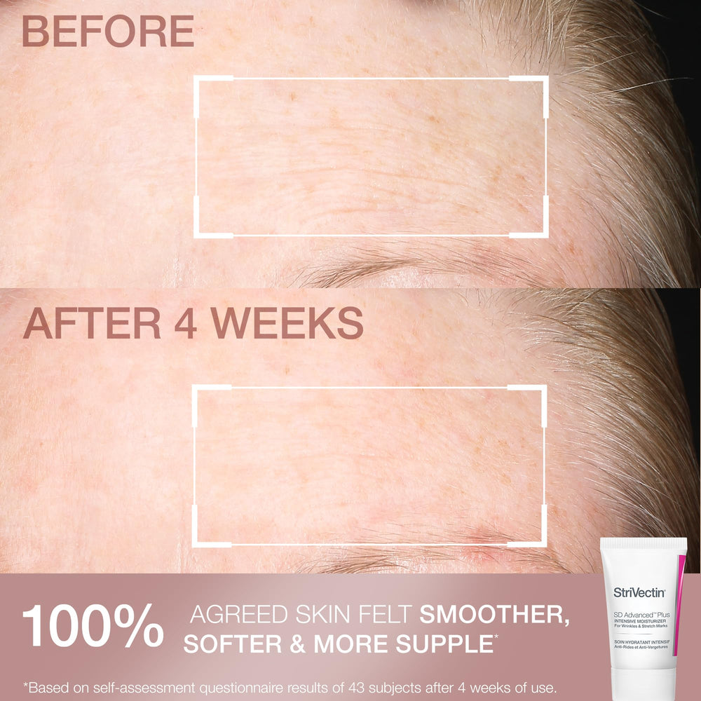 Eye cream application near the orbital area for a smoother look.