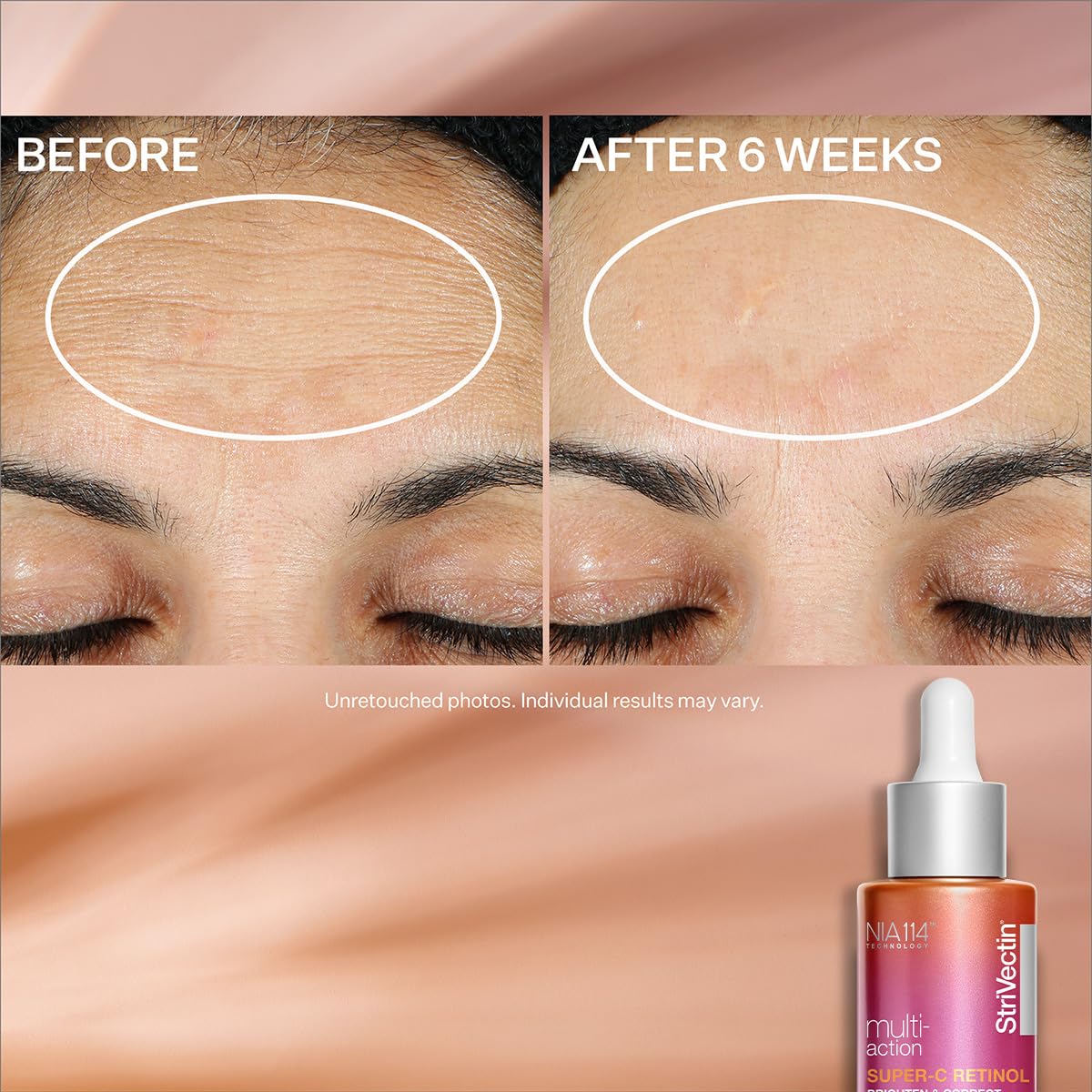 StriVectin Super C Serum Acerola Extract close-up signals natural antioxidant source