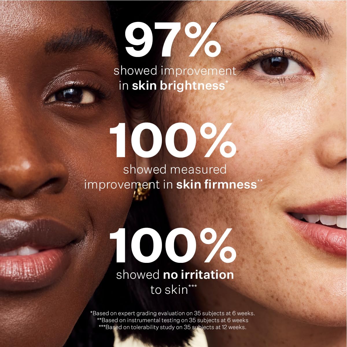 StriVectin Super C Serum glow shot highlights radiant complexion