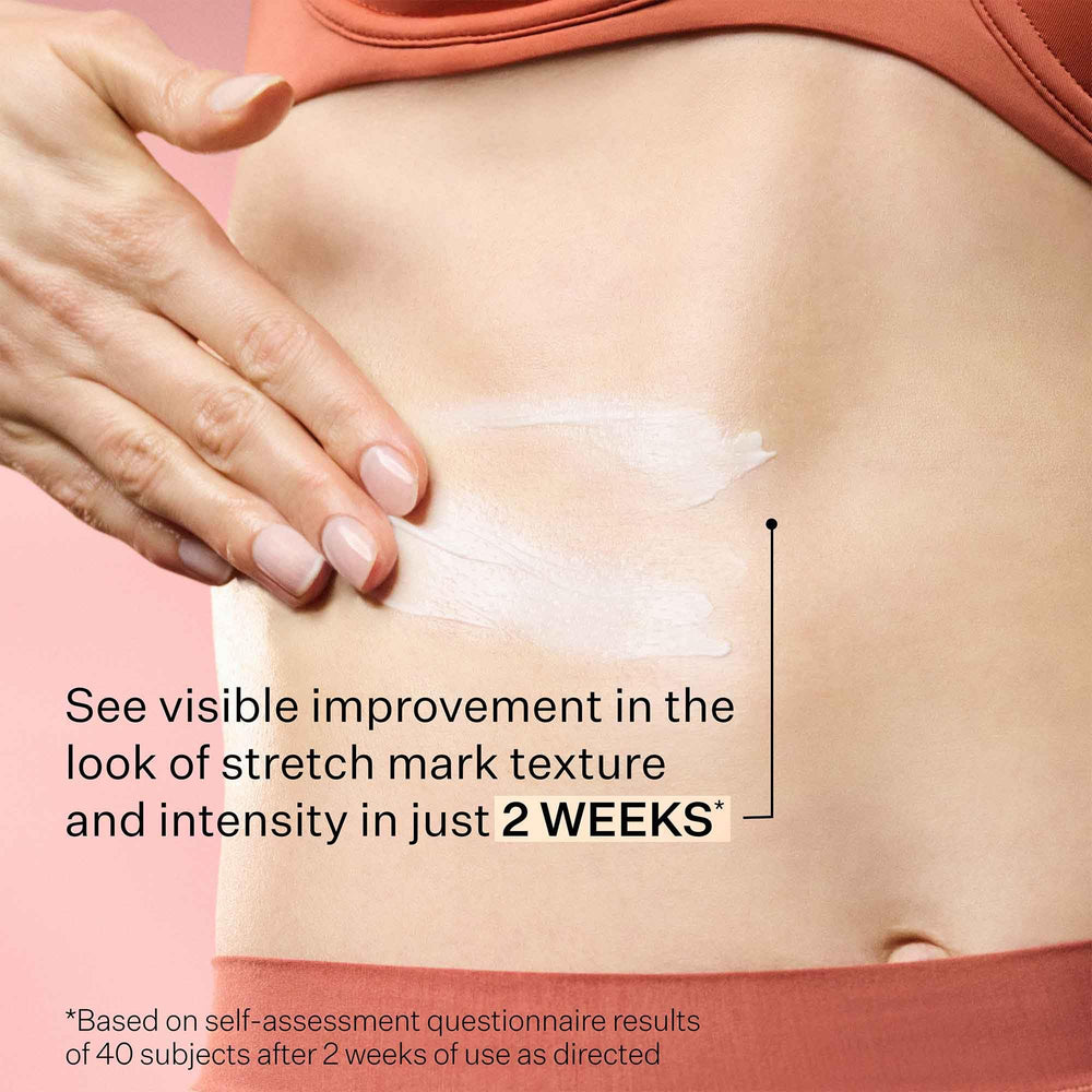StriVectin SD Advanced Plus body application scene for stretchmark care