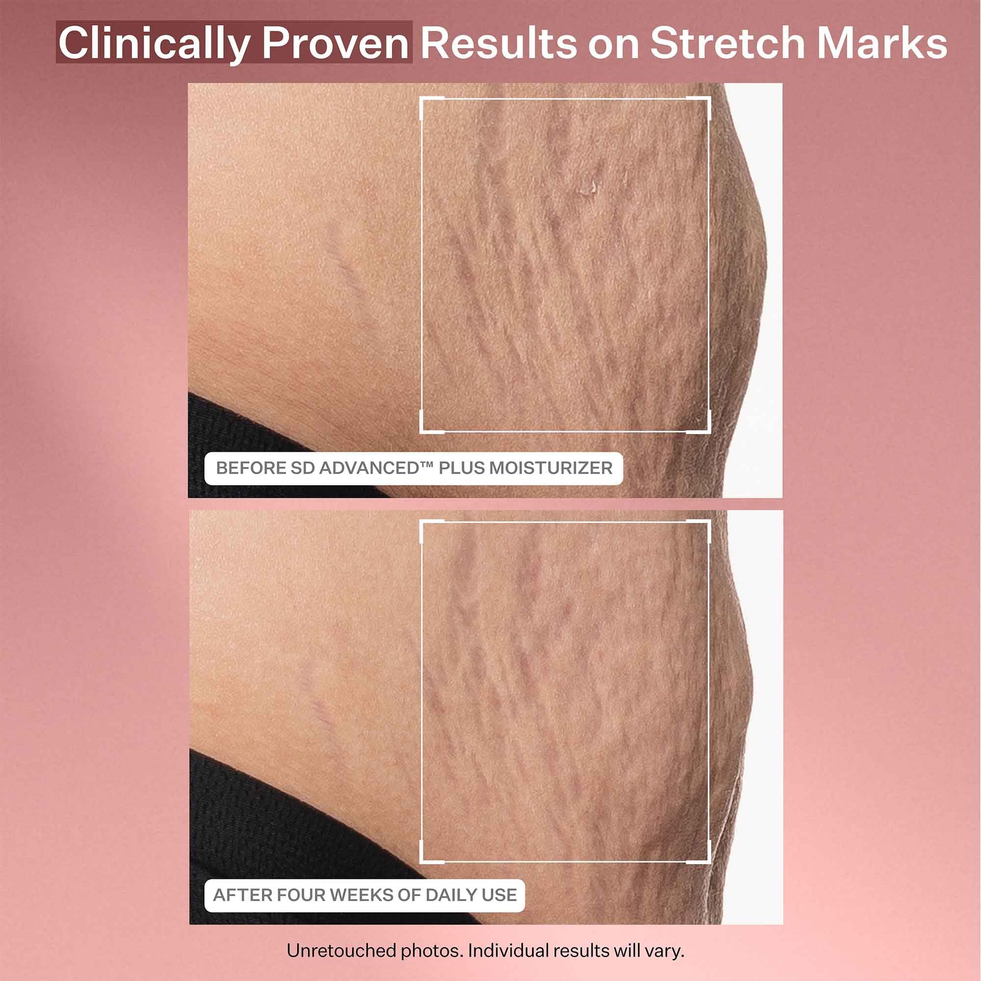 StriVectin SD Advanced Plus hyaluronic acid texture close-up.