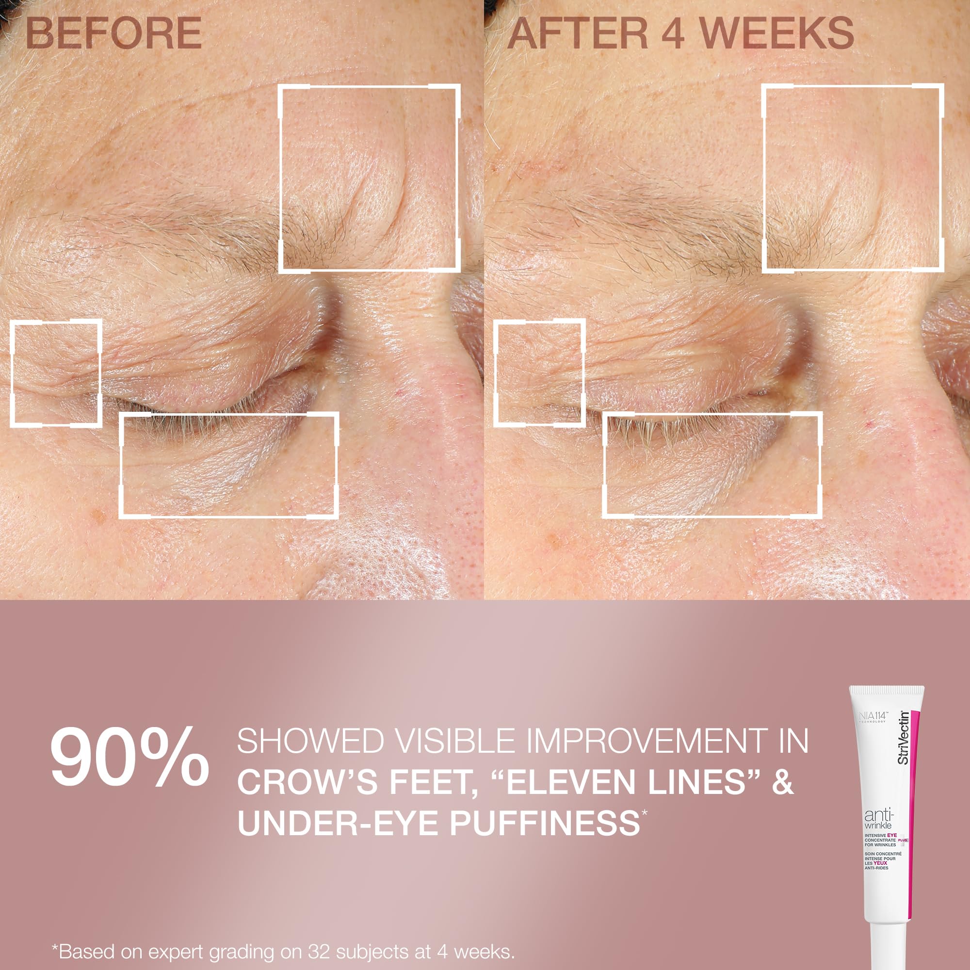 Display of StriVectin skincare set with two full-size products.
