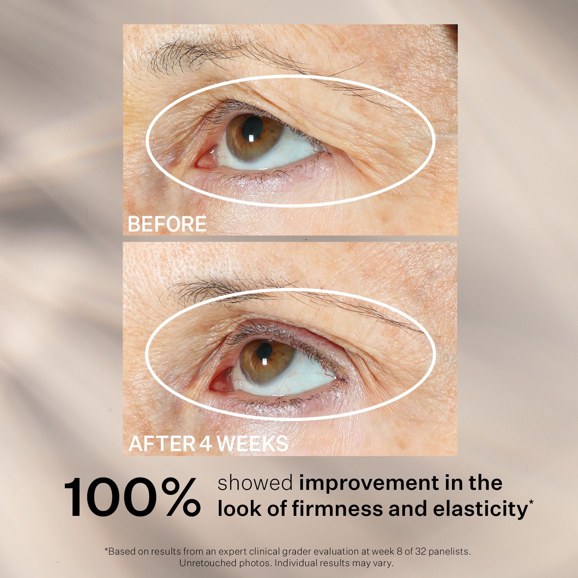 StriVectin Tighten 360 Eye Serum outer package highlighting premium formulation.