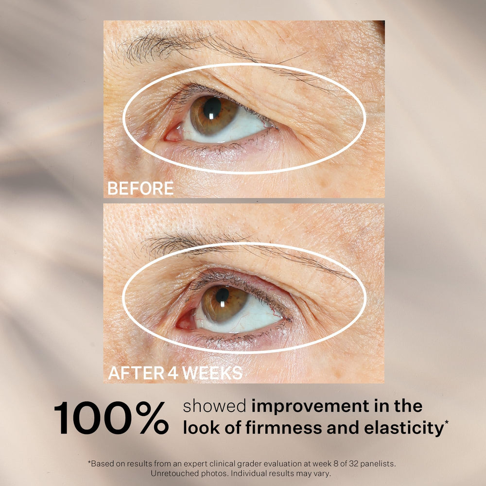StriVectin Tighten 360 Eye Serum outer package highlighting premium formulation.