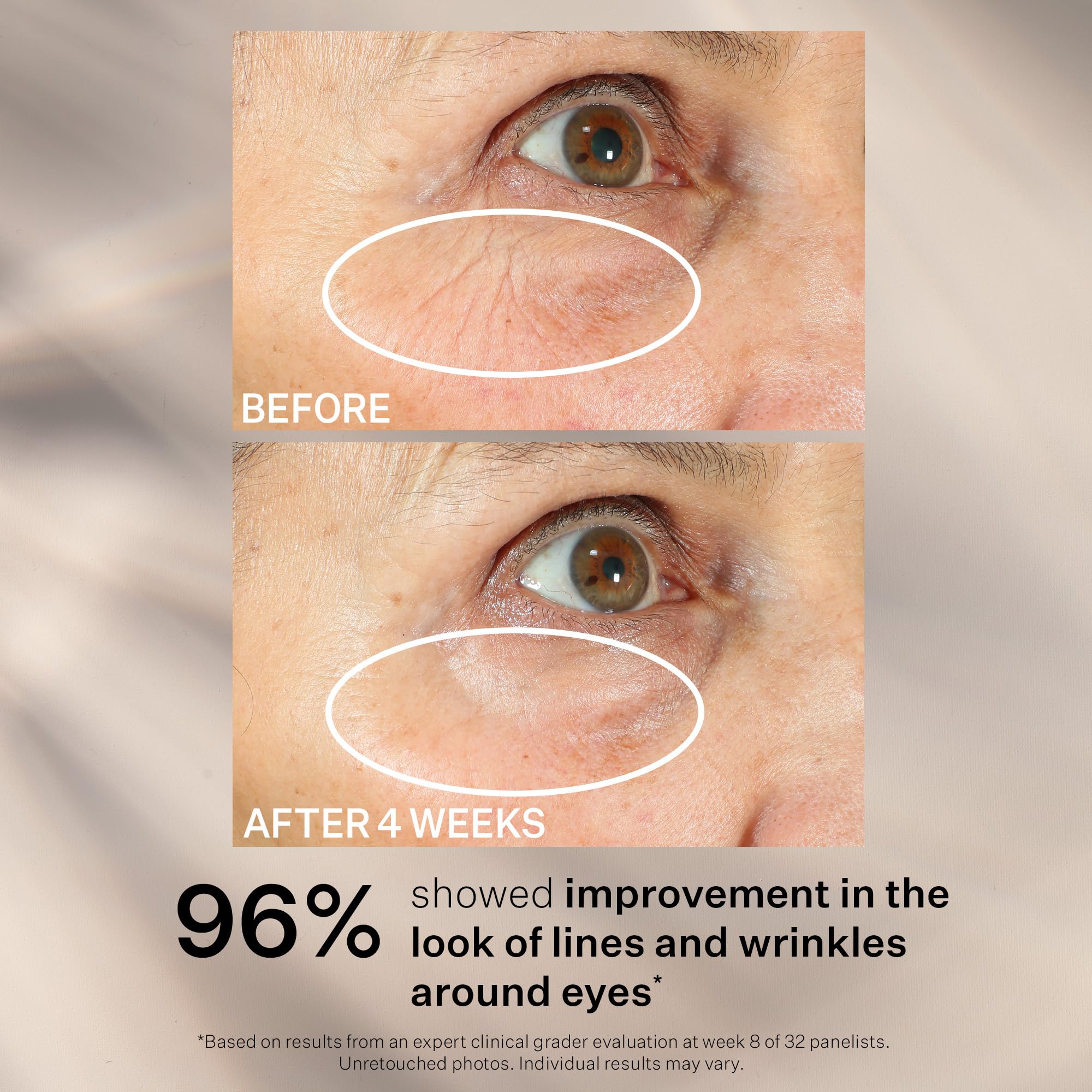 StriVectin Tighten 360 Eye Serum under-eye applying gently for smoother skin.