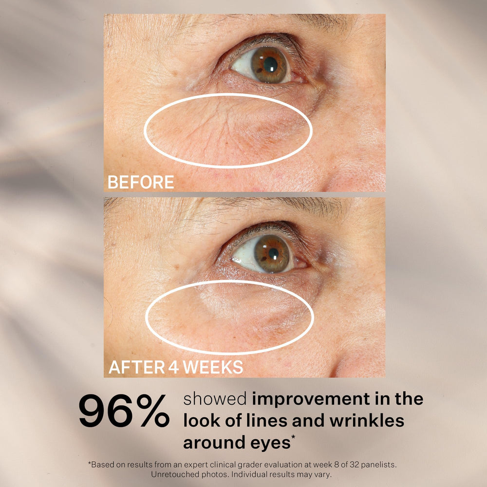 StriVectin Tighten 360 Eye Serum under-eye applying gently for smoother skin.