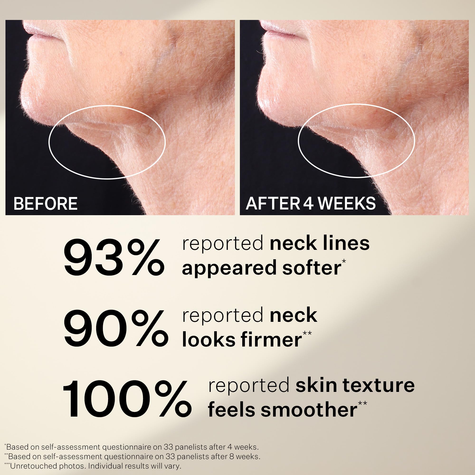 StriVectin Tighten & Lift Neck Serum Roller beside peptide ingredients