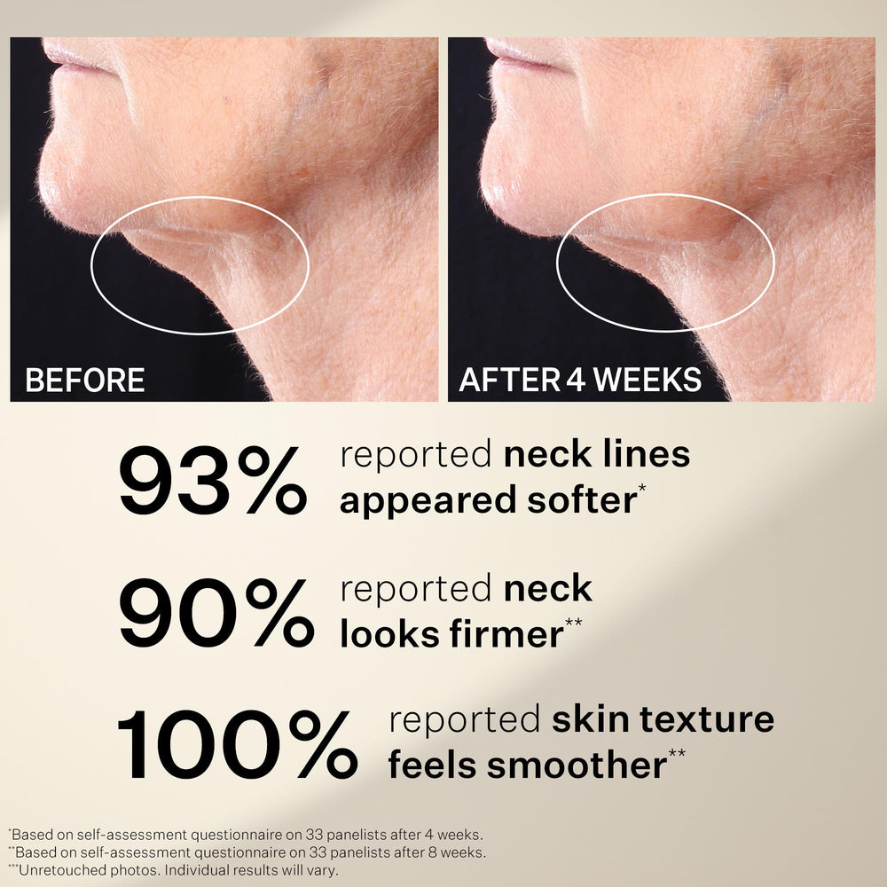 StriVectin Tighten & Lift Neck Serum Roller beside peptide ingredients