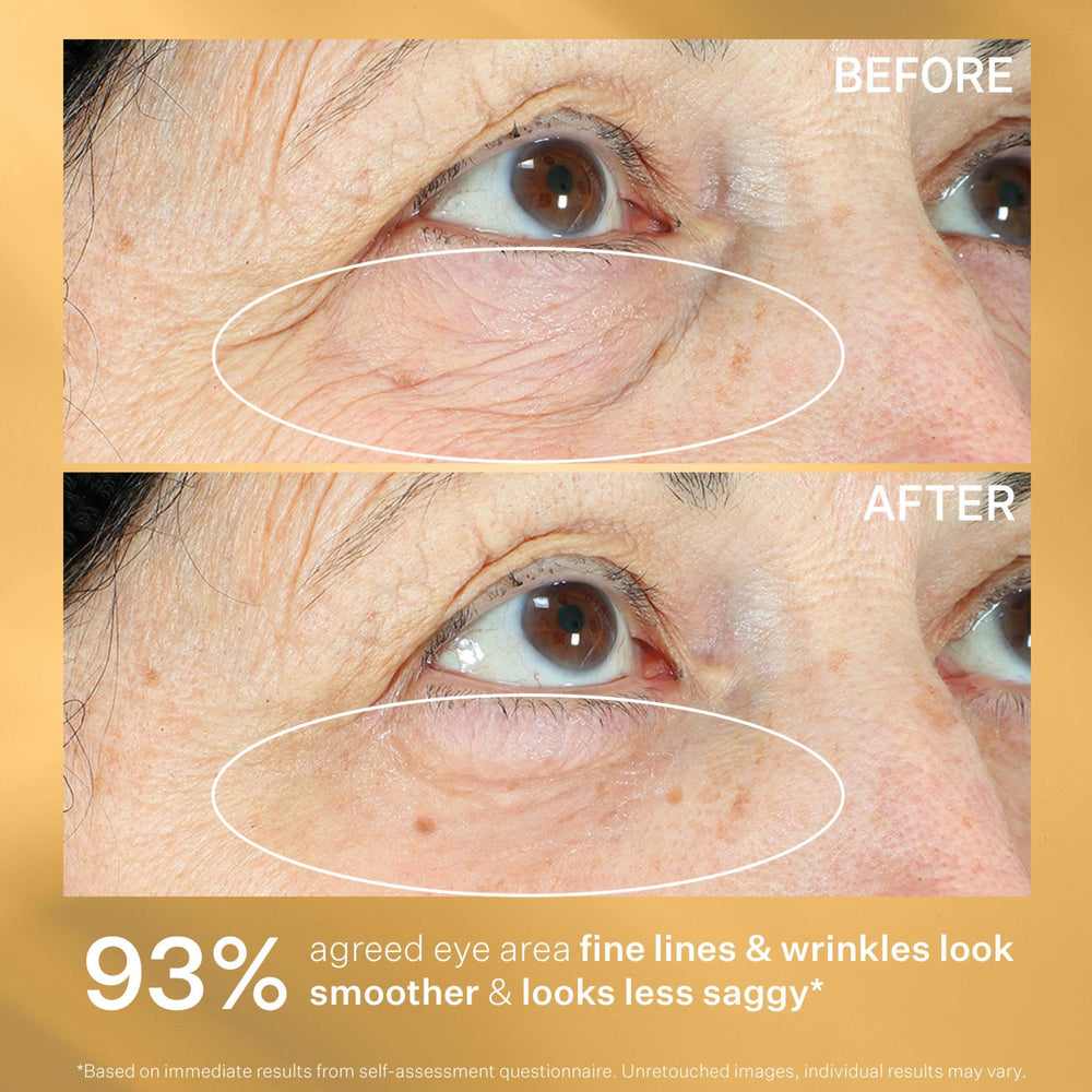 StriVectin Tighten & Lift Eye Cream suitable for day and night use