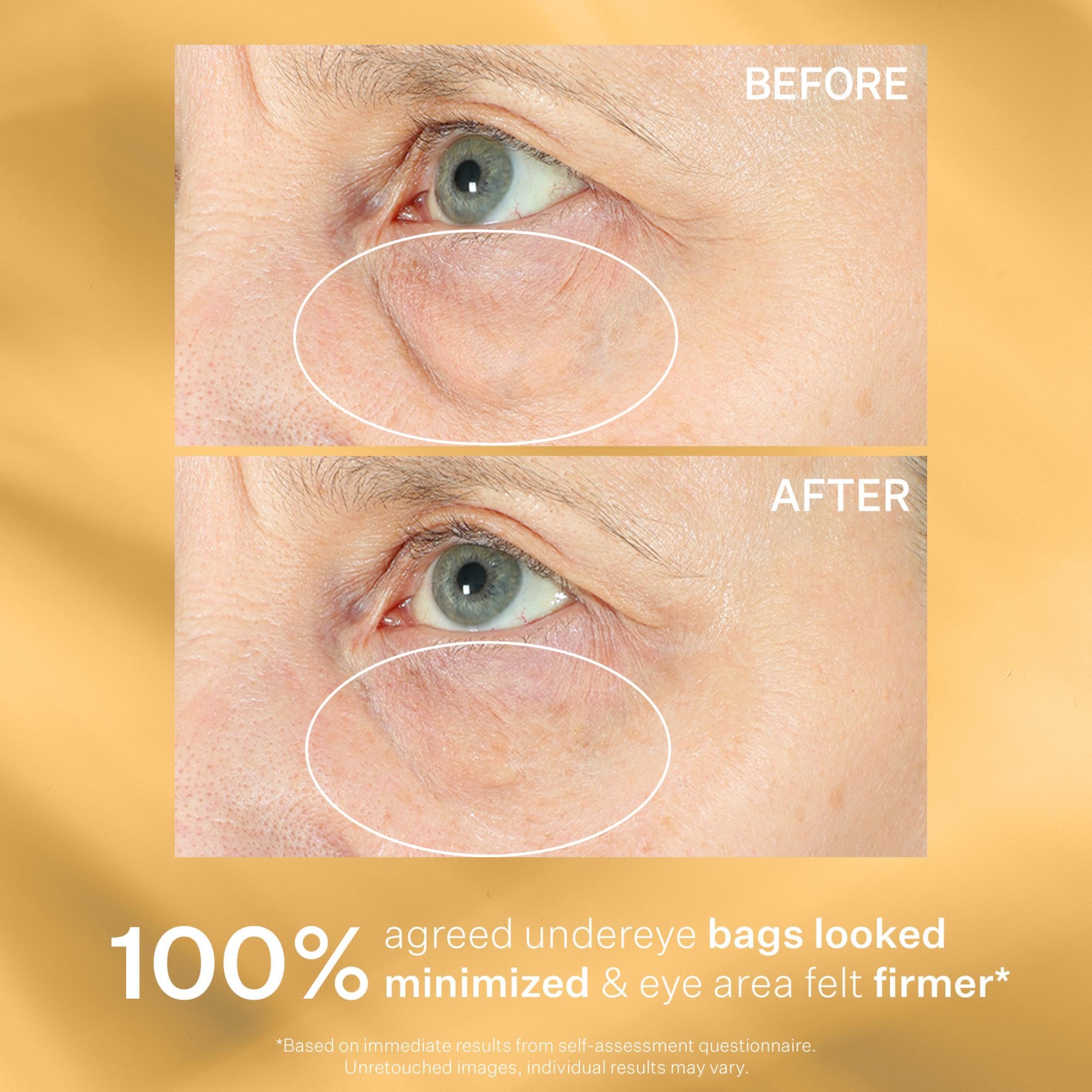 StriVectin Tighten & Lift Eye Cream uses seed-size dose for controlled application