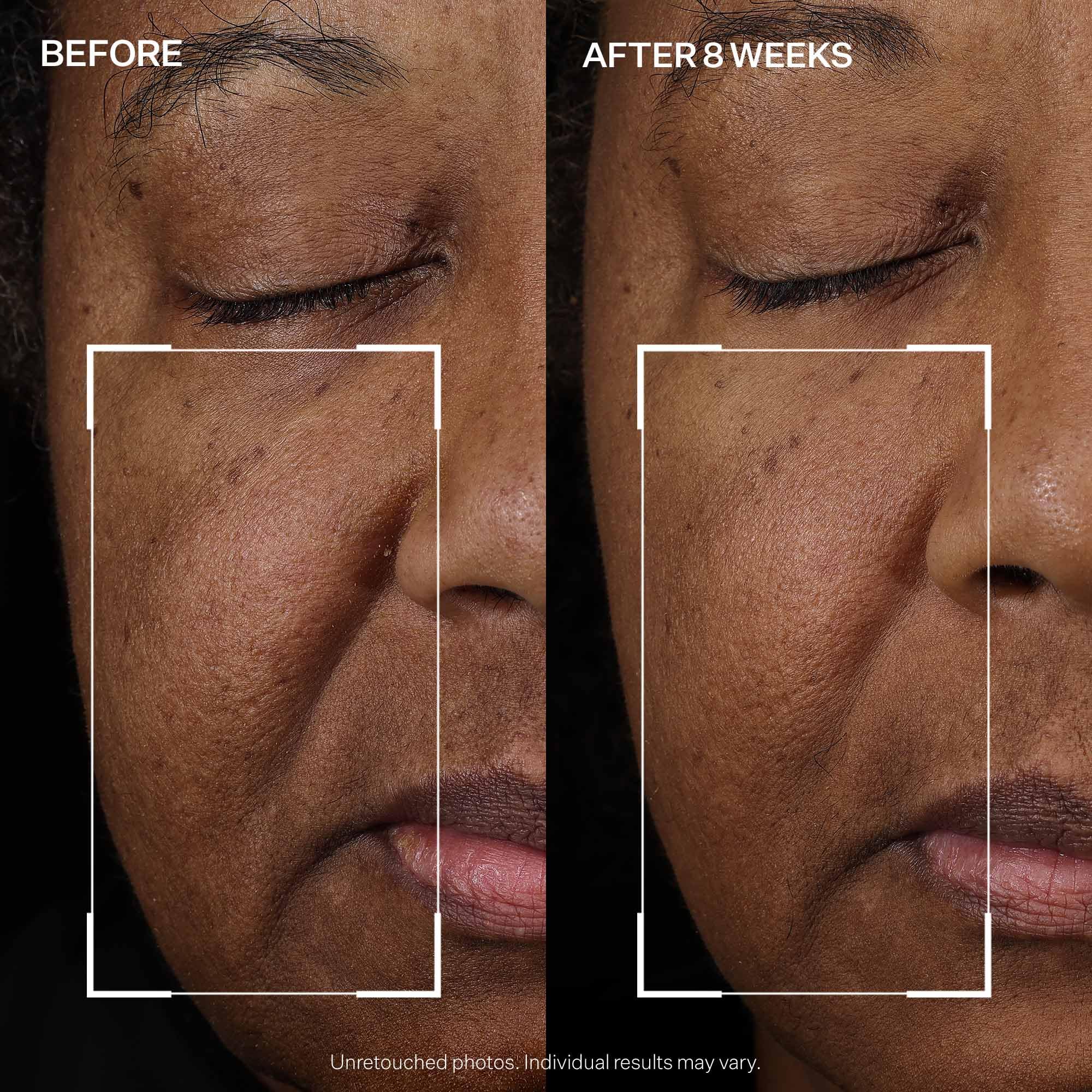 Before-and-after-inspired layout hints at firmer-feeling skin with regular StriVectin use.