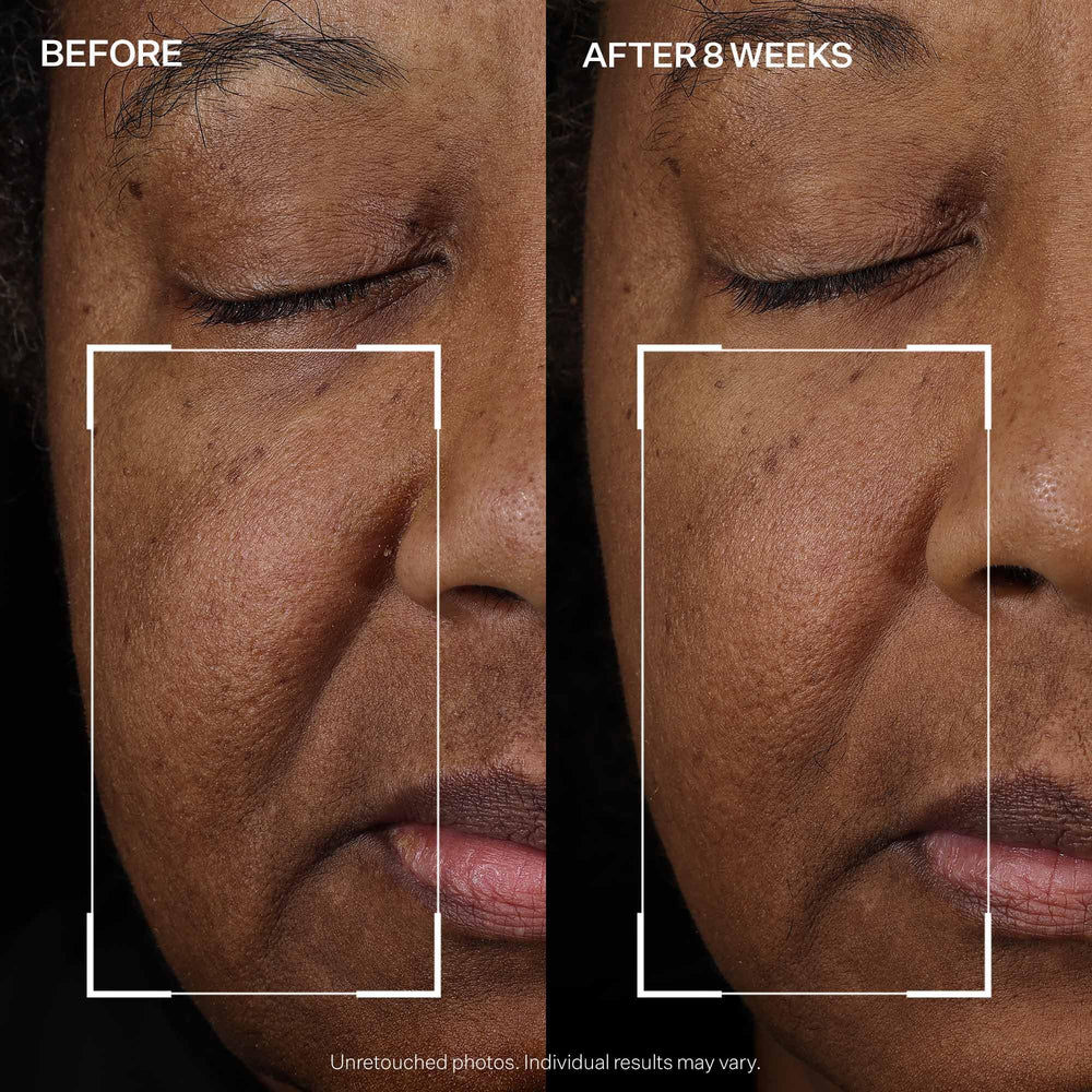 Before-and-after-inspired layout hints at firmer-feeling skin with regular StriVectin use.