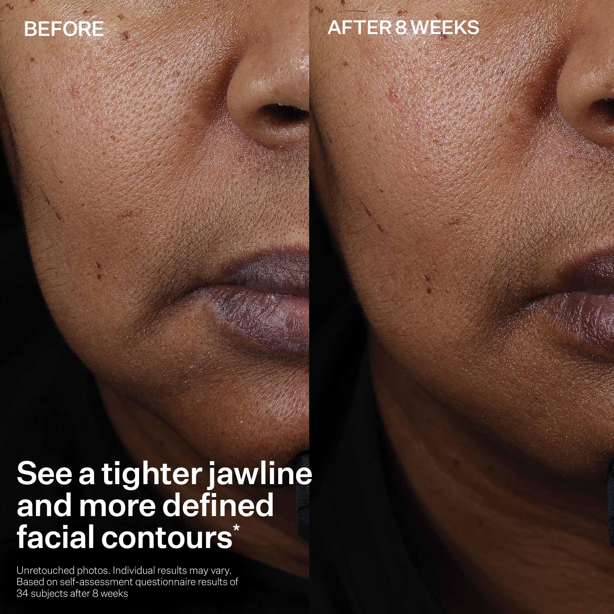 Packaging box and bottle present a clinical aesthetic for skincare routines with StriVectin.