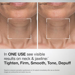 StriVectin TL Advanced: aplicación de mascarilla en cuello y mandíbula.