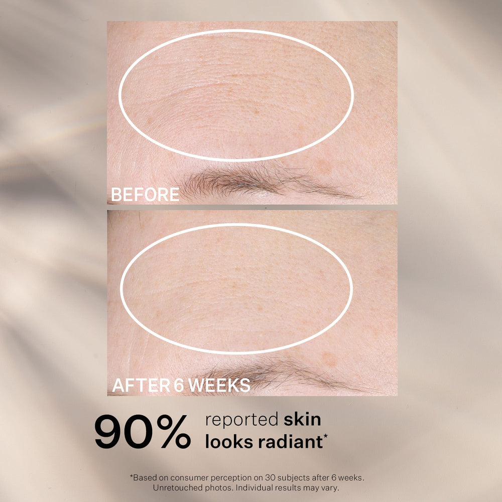 Vitamin C brightening effect implied by StriVectin product packaging.