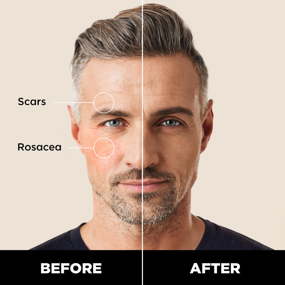 Stryx Concealer Tool applying concealer on the face for natural blend