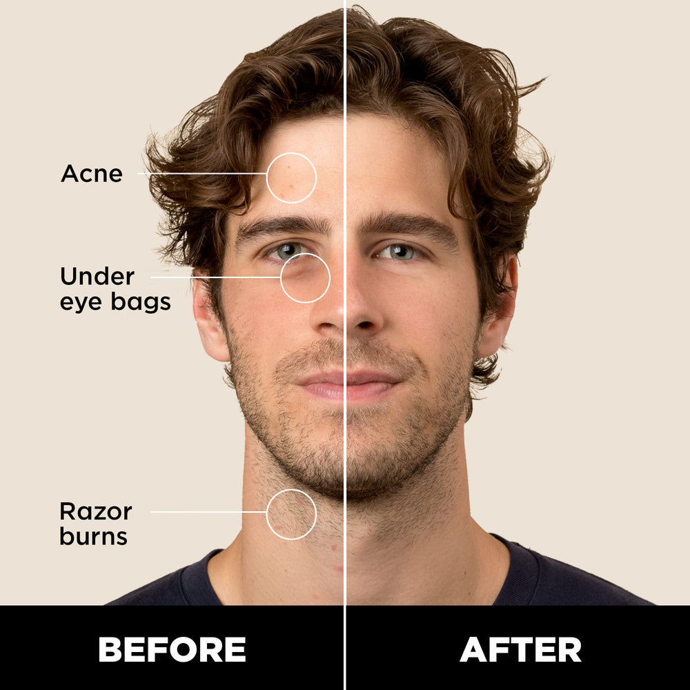 Stryx Concealer Tool twist mechanism shown for precise application