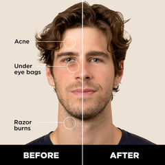 Stryx Concealer Tool twist mechanism shown for precise application