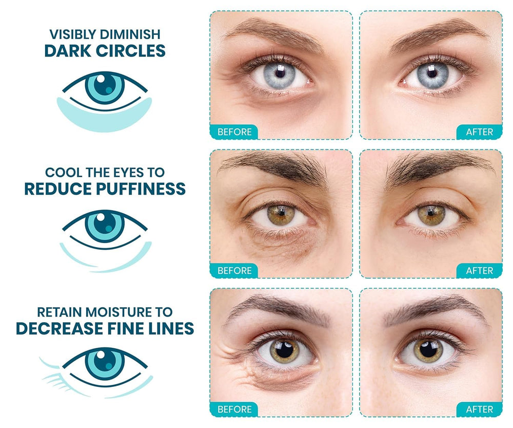 Stylia parches ojeras nutrientes hidratantes, piel descansada en minutos.